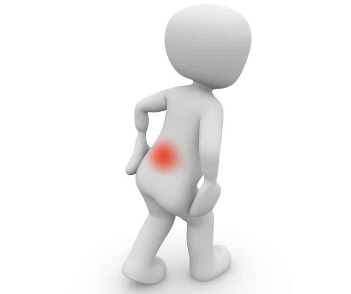 location of pilonidal cyst pain