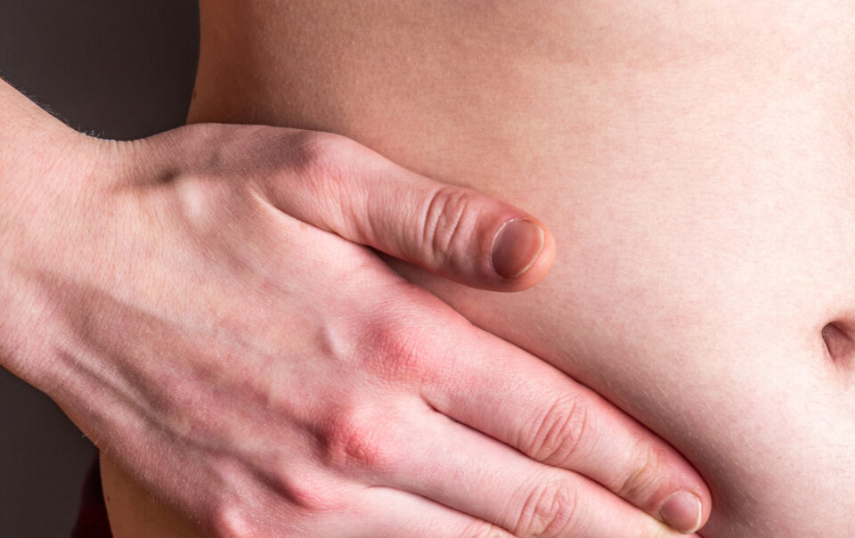 man holding stomach due to swelling post hernia surgery